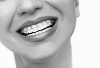 Shields Dental & Implant Clinic Limerick image 5