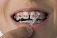 Susan Crean Dental & Facial Aesthetics image 46