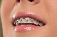 Susan Crean Dental & Facial Aesthetics image 50