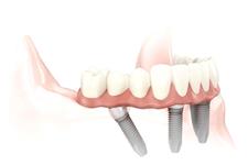 Bowe Dental Clinic image 4