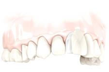 Bowe Dental Clinic image 3