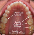 Cheap Veneers and Dentures, Cosmetic Dentistry in Westmeath &Denture Repairs in image 4