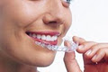 Dunshaughlin Orthodontics Clinic image 2