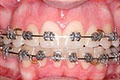 Dunshaughlin Orthodontics Clinic image 3