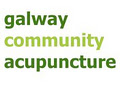 Galway Community Acupuncture • Affordable, Sliding Scale. image 1