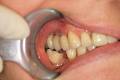 New Smile Dental Clinic image 2