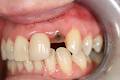 New Smile Dental Clinic image 4