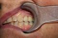 New Smile Dental Clinic image 5