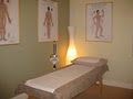 Shen Dao Acupuncture image 1