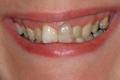 Claire Rath BDS MClinDent(Prosthodontics) image 2