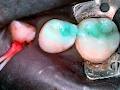 Claire Rath BDS MClinDent(Prosthodontics) image 4