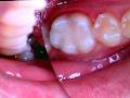 Claire Rath BDS MClinDent(Prosthodontics) image 5