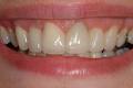 Claire Rath BDS MClinDent(Prosthodontics) image 6