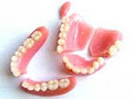 broken dentures . cork image 1