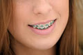 Glasnevin Orthodontics image 3