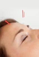 Aspire Health Acupuncture & Massage D2 image 5