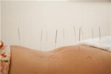 Dublin Acupuncture Rooms image 1